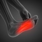 【理学療法士が解説】足底腱膜炎と思いきや…実は後脛骨筋炎だった？｜見逃しやすい足の痛みの正体とは